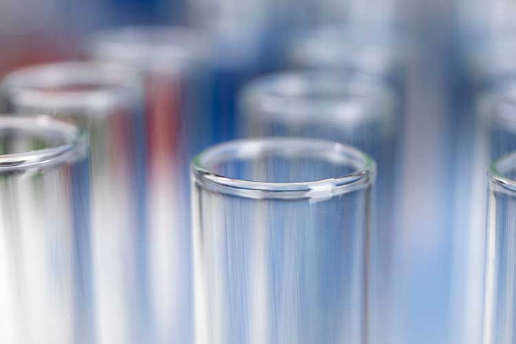 Vidro Borossilicato: por que é essencial em vidrarias de laboratório